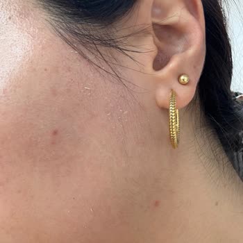 Yves Rocher Ürünleri Cildimde Soyulma Yaptı