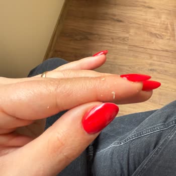 Yves Rocher Ürünleri Cildimde Soyulma Yaptı