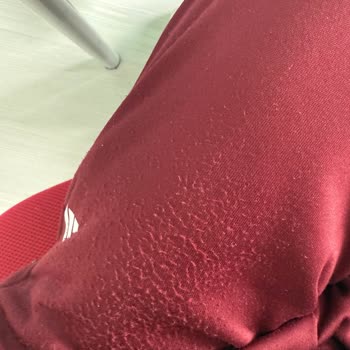 FLO Mağazasından Alınan Adidas Eşofman Takımında Kalite Sorunu