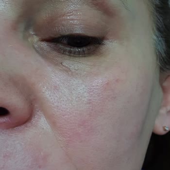 Bioderma Ürünleri Cildimde Sorun Yarattı