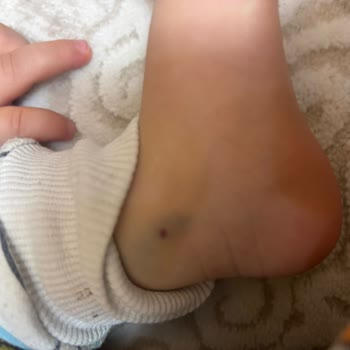 Hastanede İhmalkarlık Ve Yanlış Uygulama Şikayeti