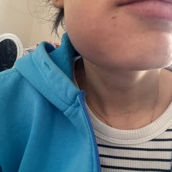 Eksik Kanal Tedavisi Ve İlgisizlik