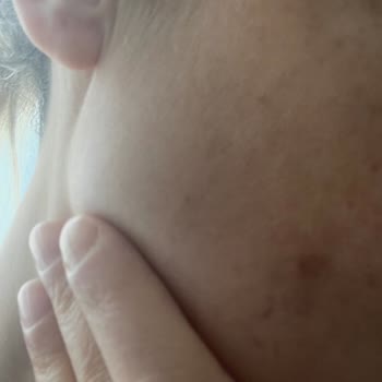 Başarısız Estetik Operasyon Ve Mağduriyet