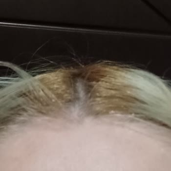 Saç Boyası Derimi Yakıyor Ve Renk Kalıcılığı Sorunu