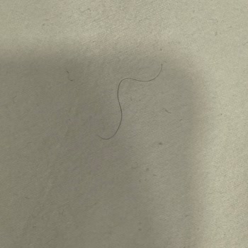 Batman Öğretmenevi'nde Hijyen Sorunu: Kirli Odalar Ve Yetersiz Temizlik