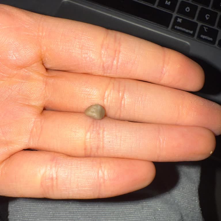 Fıstık Ezmesinde Taş Tehlikesi