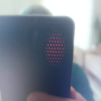 Philips TV'de Ekran Sorunu Ve Servis Hayal Kırıklığı