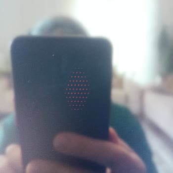 Philips TV'de Ekran Sorunu Ve Servis Hayal Kırıklığı