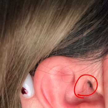 Kalitesiz Kulak Pamuğu Sağlık Sorunlarına Yol Açtı