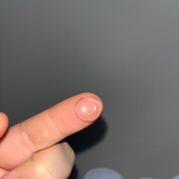 Acuvue Oasys Lenslerin Dayanıklılığı Hakkında Şikayet