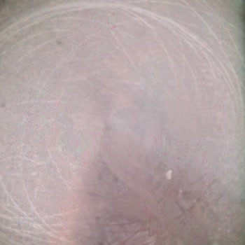 Aryıldız Paslanan Çelik Tencere Seti Sorunu