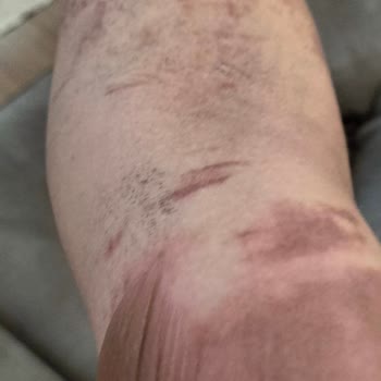 Patlayan Düdüklü Tencere Ve İlgisizlik