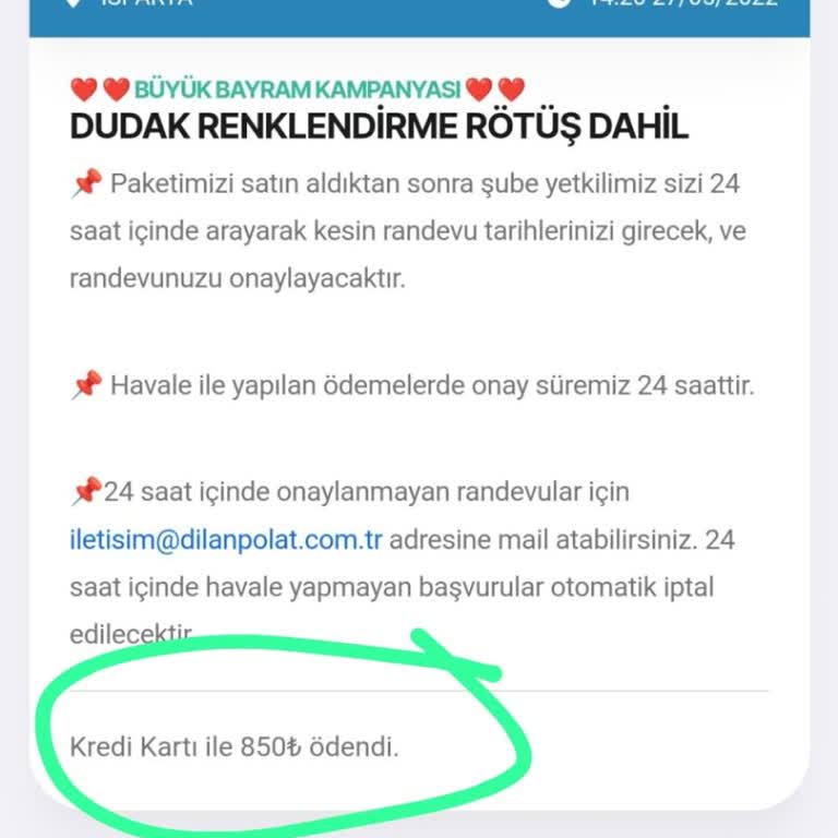 Paketlerimin Yanması Ve Mağduriyetim
