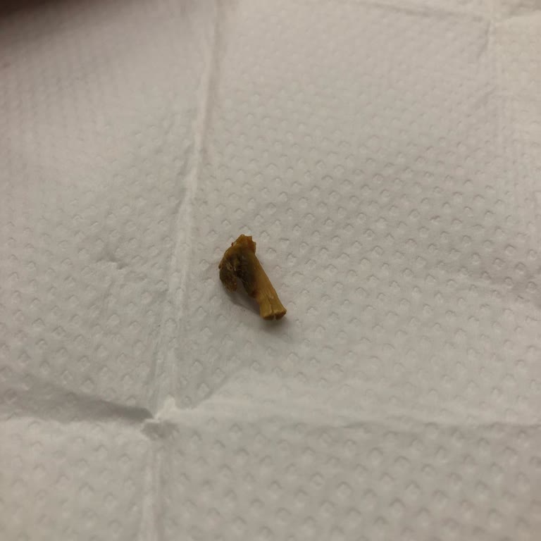 Köfteci Yusuf'tan Gelen Sucuk Skandalı: Tavuk Kemiği Şoku!