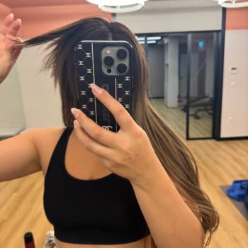 Burak Çınar Hair Stüdyo Saçımı Yaktı