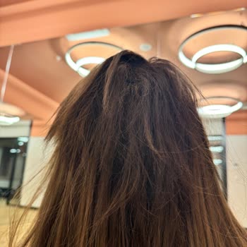 Burak Çınar Hair Stüdyo Saçımı Yaktı