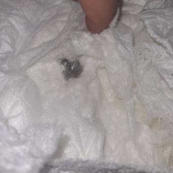 Bebek Bezi İçinden Çıkan Beklenmedik Madde