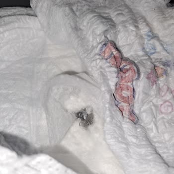 Bebek Bezi İçinden Çıkan Beklenmedik Madde