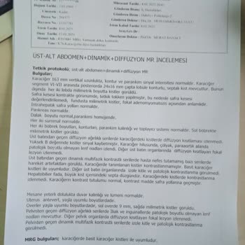 PTT'de Bekleyen Kargo Kabusu