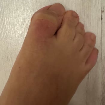 Lacoste Botlar Baş Parmaklarımı Mahvetti