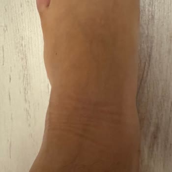 Lacoste Botlar Baş Parmaklarımı Mahvetti