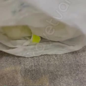 Prima Premium Care Bebek Bezi Yırtılıyor Ve Pişiğe Sebebiyet Veriyor!