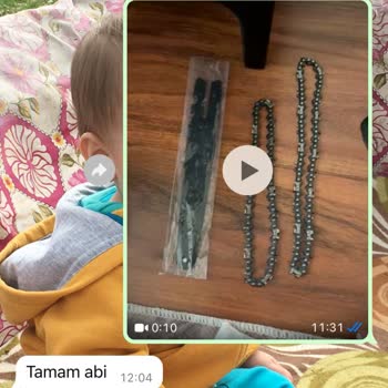 Eksik Parçalar Ve Kötü Batarya Performansı