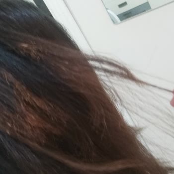 Fön Tarağı Saçımı Yaktı!