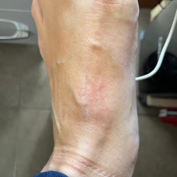 Nike Ayakkabıda Rahatsızlık Ve İade Sorunu