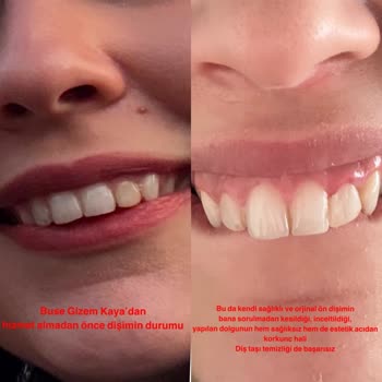 Dental Hizmette Hayal Kırıklığı Ve Mağduriyet