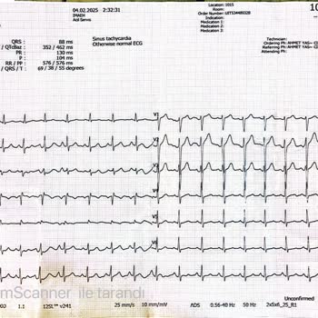 Biletix İade Sürecinde Yaşanan Sorunlar