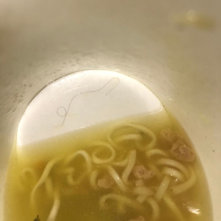 İndomie Noodle'da Saç Çıkması Ve Sağlık Sorunları