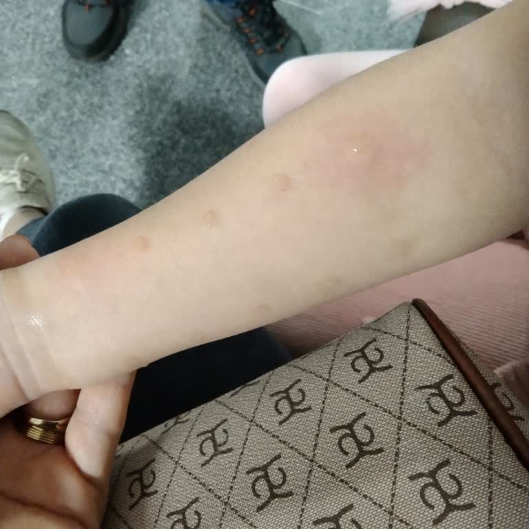 Alerji Testinde Saygısız Hizmet