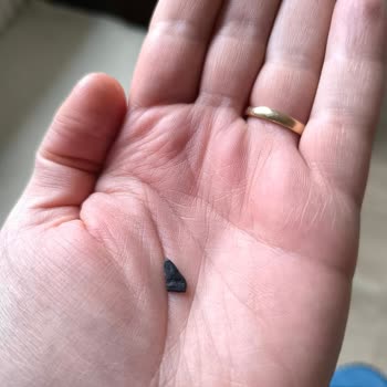 Ballı Pestilden Çıkan Plastik Parçası Dişimi Kanattı