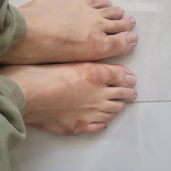 Skechers Ayakkabıda Boya Sorunu