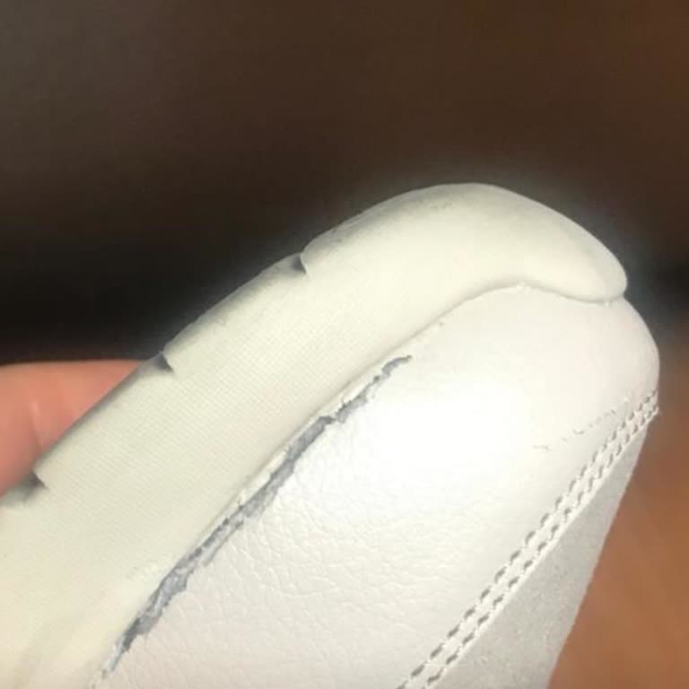 Skechers Ayakkabının Kalitesizliği Ve Firma Desteği Eksikliği