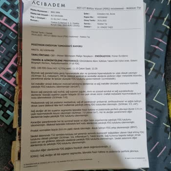 Bilet İptalinde Bürokrasi Engeli