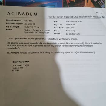 Bilet İptalinde Bürokrasi Engeli