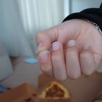 Pide Siparişi Hayal Kırıklığı: Lezzet Ve Hijyen Sorunları