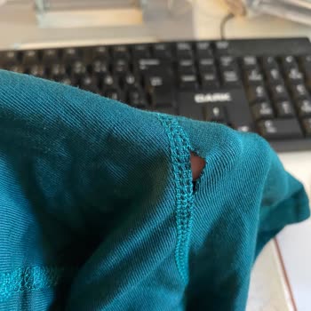 Deforme Ürün Ve Yetersiz Müşteri Hizmeti