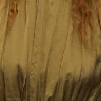 Clinimed Yanlış Çene Dolgusu ve Psikolojik Baskı