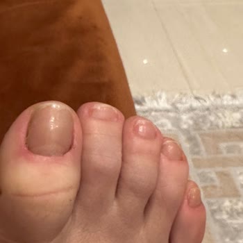 Bakırköy İpek Kirpik | By Selin Beauty Pedikür Kabusu: Ayak Sağlığım Tehlikede!