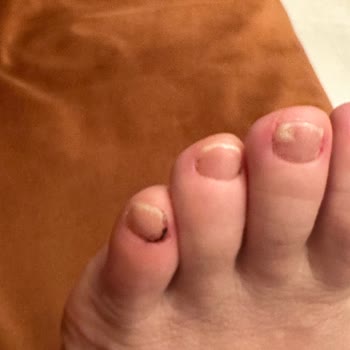 Bakırköy İpek Kirpik | By Selin Beauty Pedikür Kabusu: Ayak Sağlığım Tehlikede!