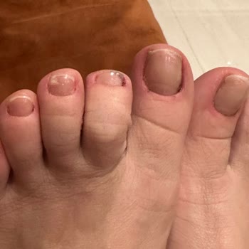 Bakırköy İpek Kirpik | By Selin Beauty Pedikür Kabusu: Ayak Sağlığım Tehlikede!