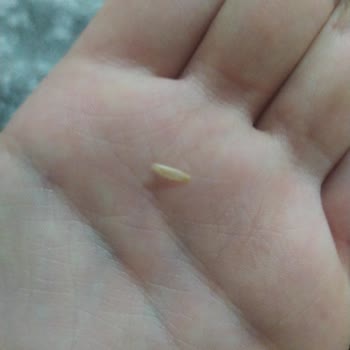 Sevilen Bisküvide Şok Edici Yabancı Madde