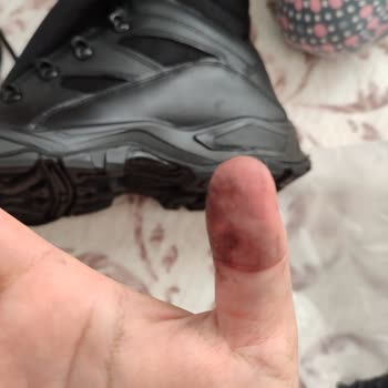 YDS Boots Defolu Ürünle Gelen Hayal Kırıklığı