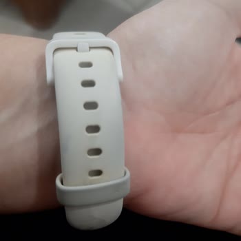 Xiaomi Watch Kordonu Bir Haftada Kapkara Oldu
