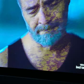 Yeni Aldığım TV'de Kanal Sorunu Yaşıyorum