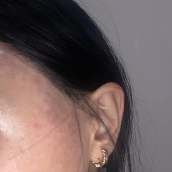 Güzellik Merkezinde Yaşanan Sorunlar