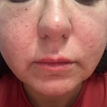 Mea Güzellik Merkezinde Hayal Kırıklığı ve İlgisizlik